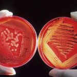 Zwei behandschuhte Hände halten jeweils eine Petrischale mit Proben in rot vor schwarzem Hintergrund.