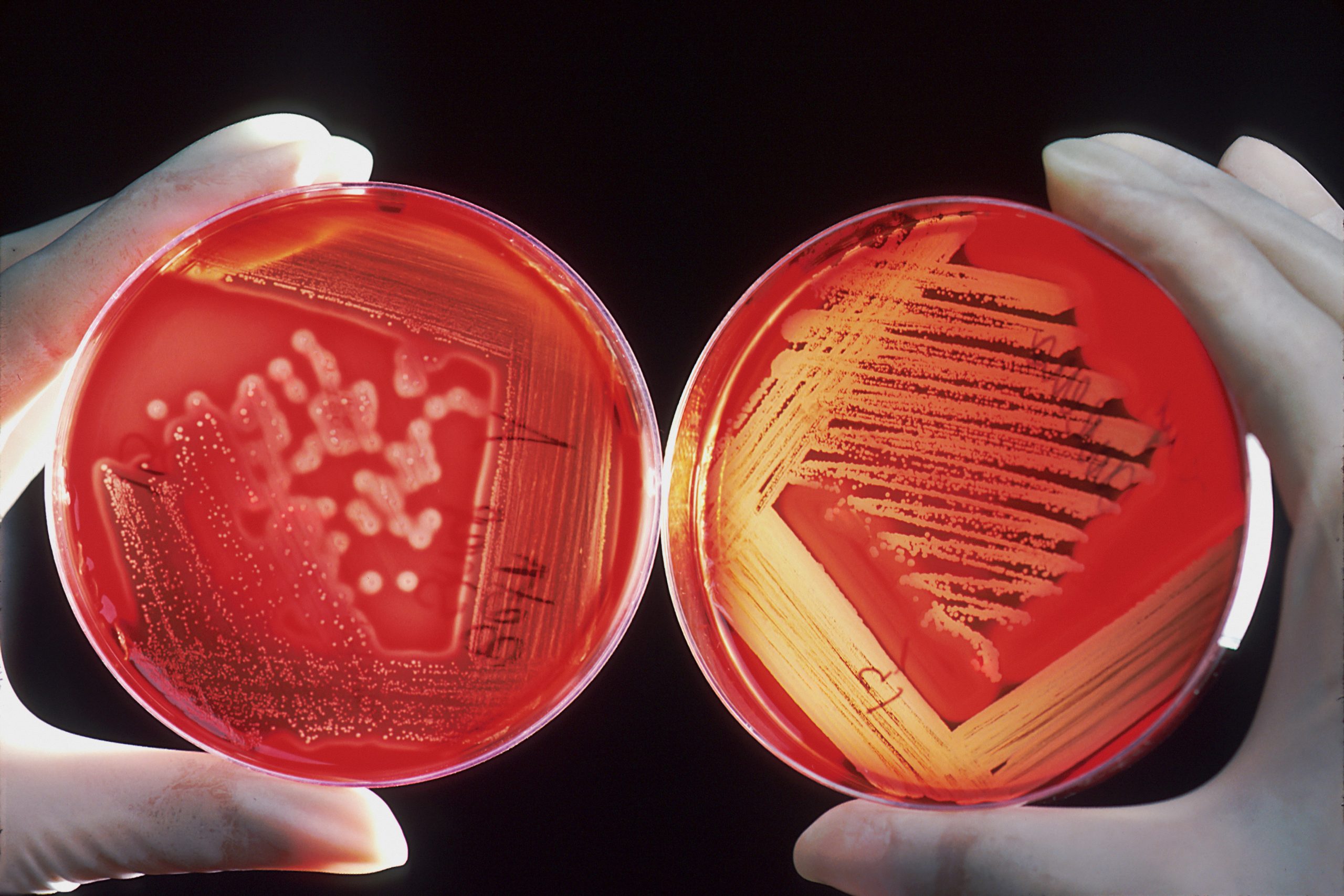 Zwei behandschuhte Hände halten jeweils eine Petrischale mit Proben in rot vor schwarzem Hintergrund.
